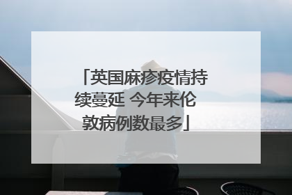 英国麻疹疫情持续蔓延 今年来伦敦病例数最多